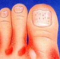 The sponge on the legs