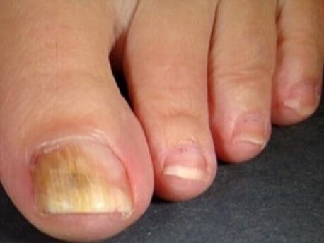 Nail sponge