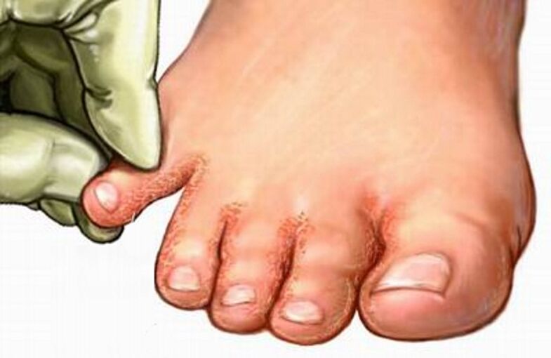 The sponge on the legs