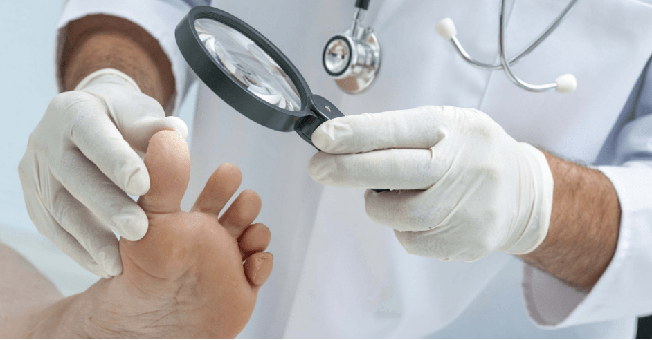 The first symptoms of the fungus on the legs