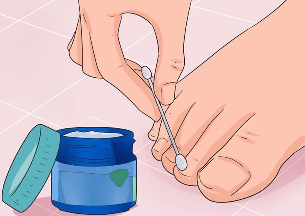 Harden to nail sponge
