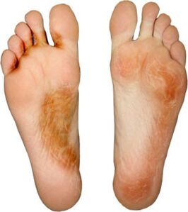 heal the sponge on the finger and don't pick it up again