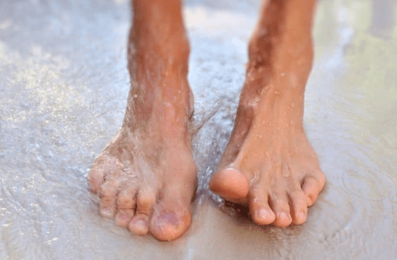 The causes of the development of mycosis